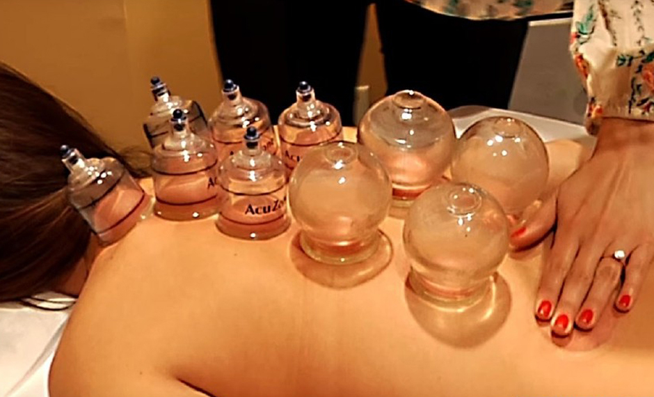 Olympic Cupping Philly